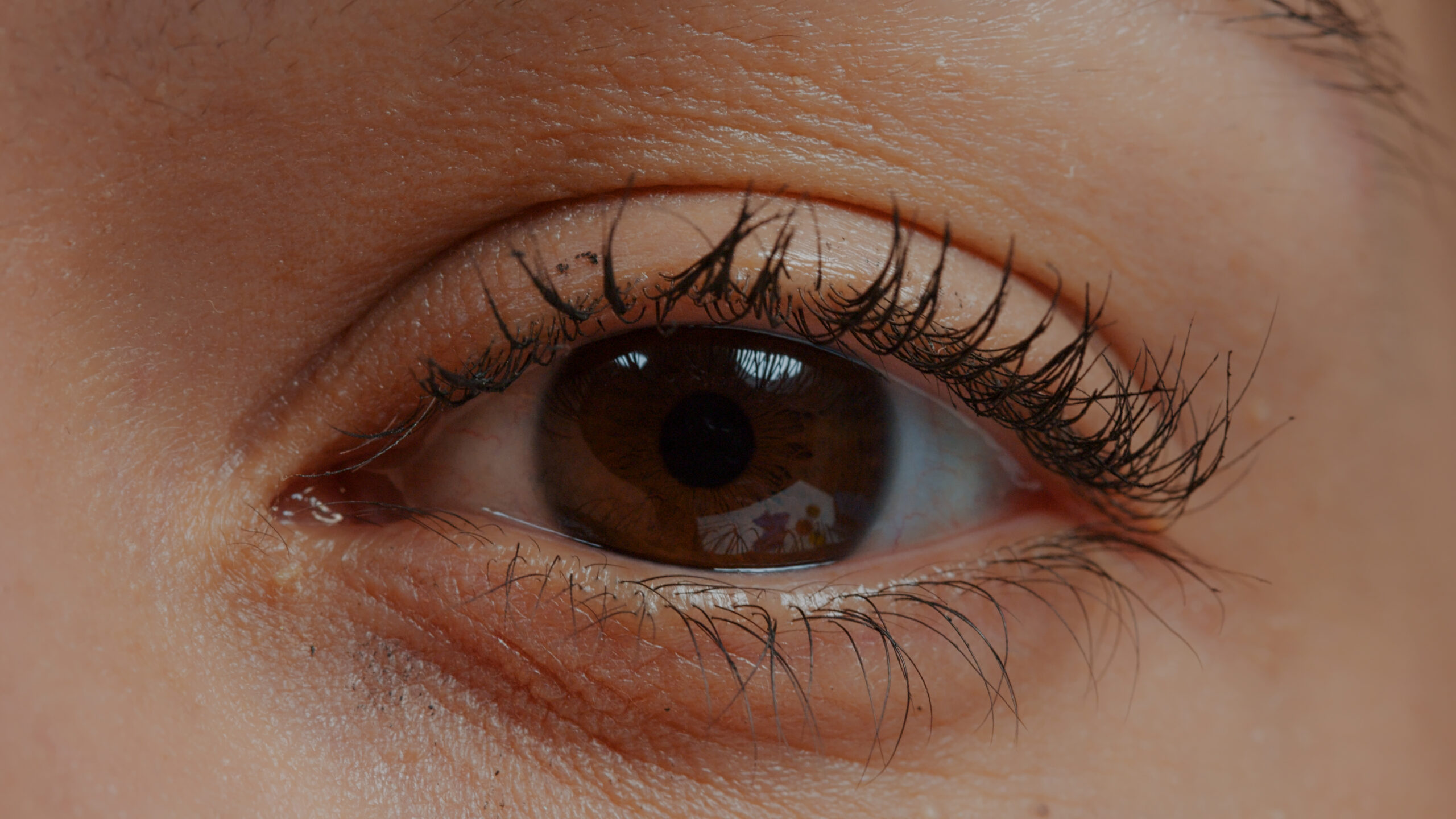 cornea